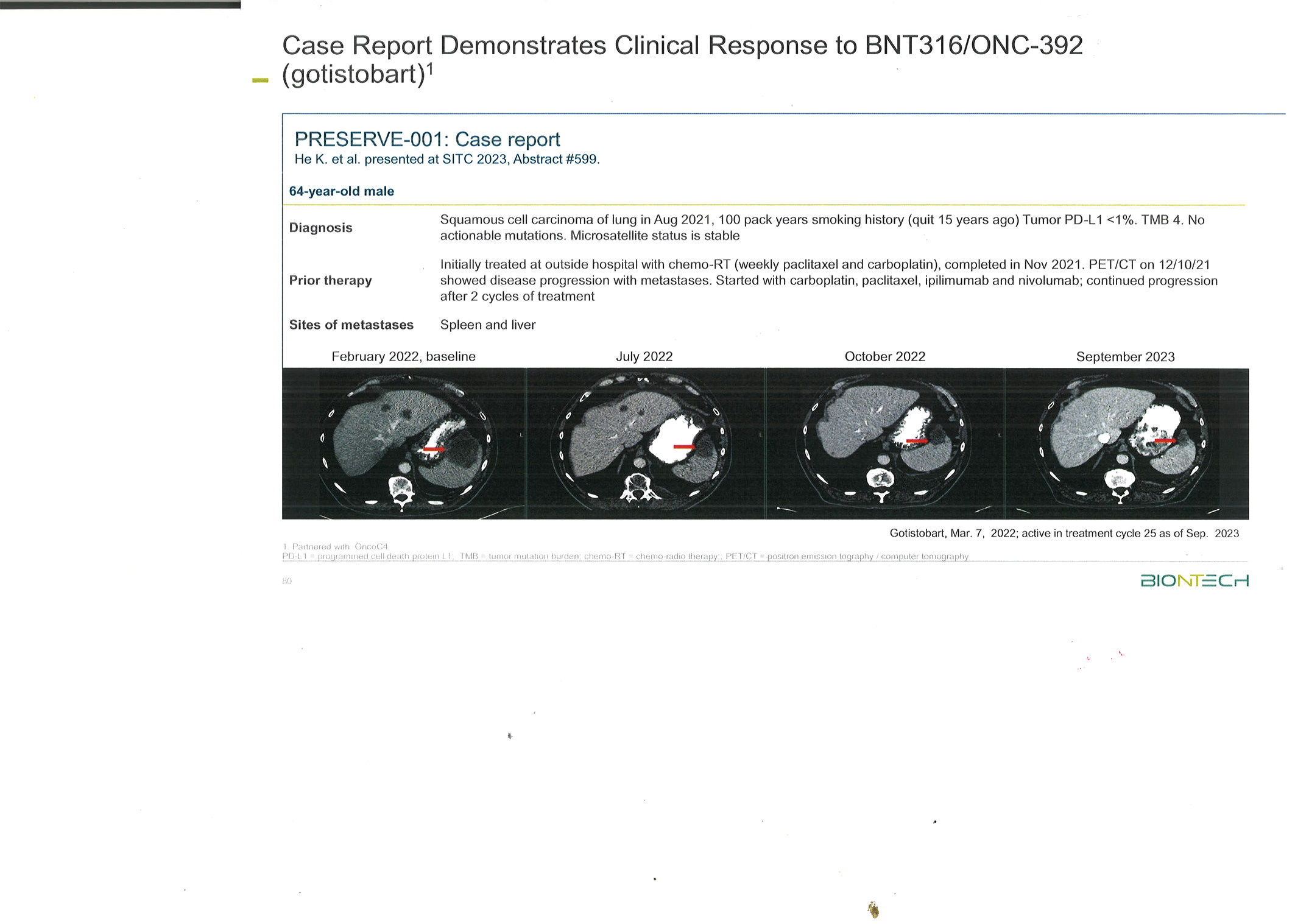 bnt316_onc_392.jpg