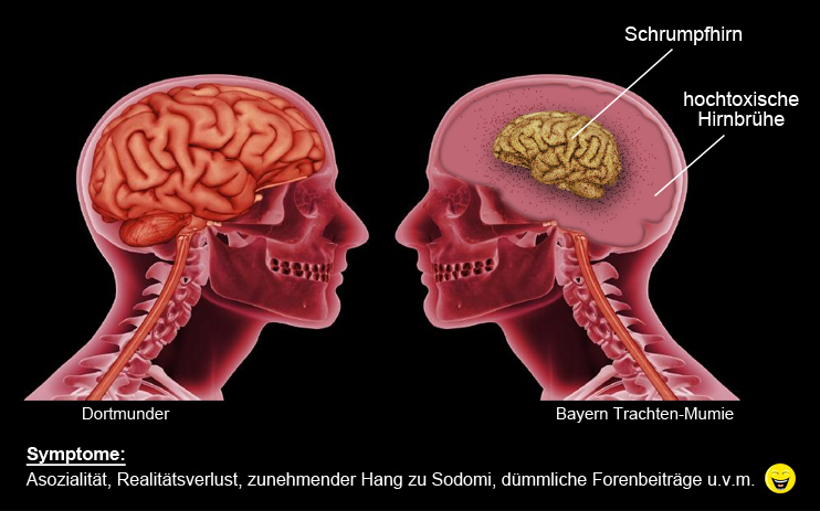 schrumpfhirn.jpg